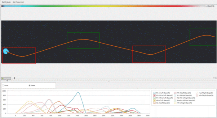 foot-scan-analysis-ahuraclinic-2