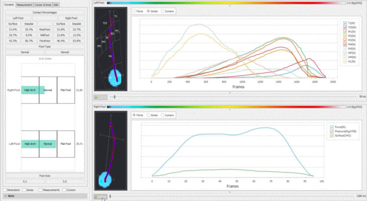 foot-scan-analysis-ahuraclinic